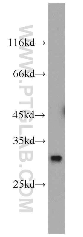 WB analysis of mouse liver using 14908-1-AP