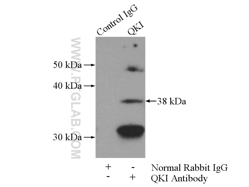 IP experiment of K-562 using 13169-1-AP