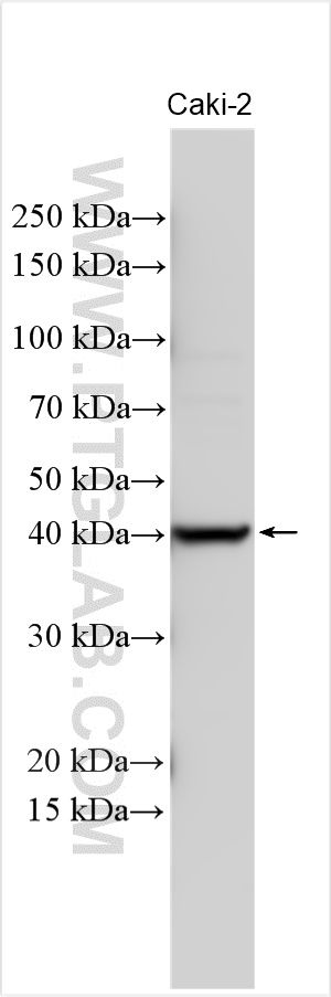 WB analysis using 18571-1-AP
