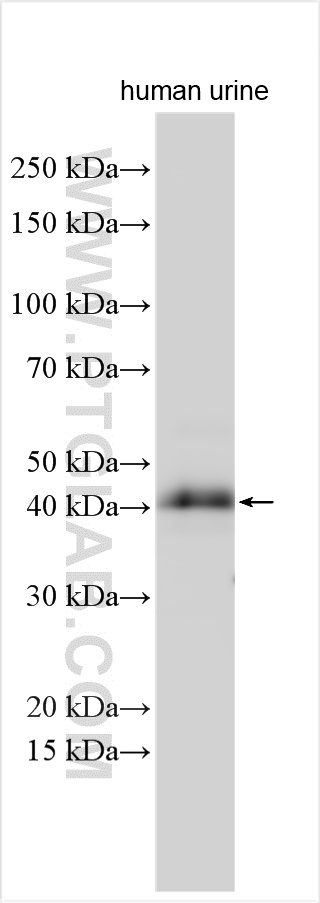 WB analysis using 18571-1-AP
