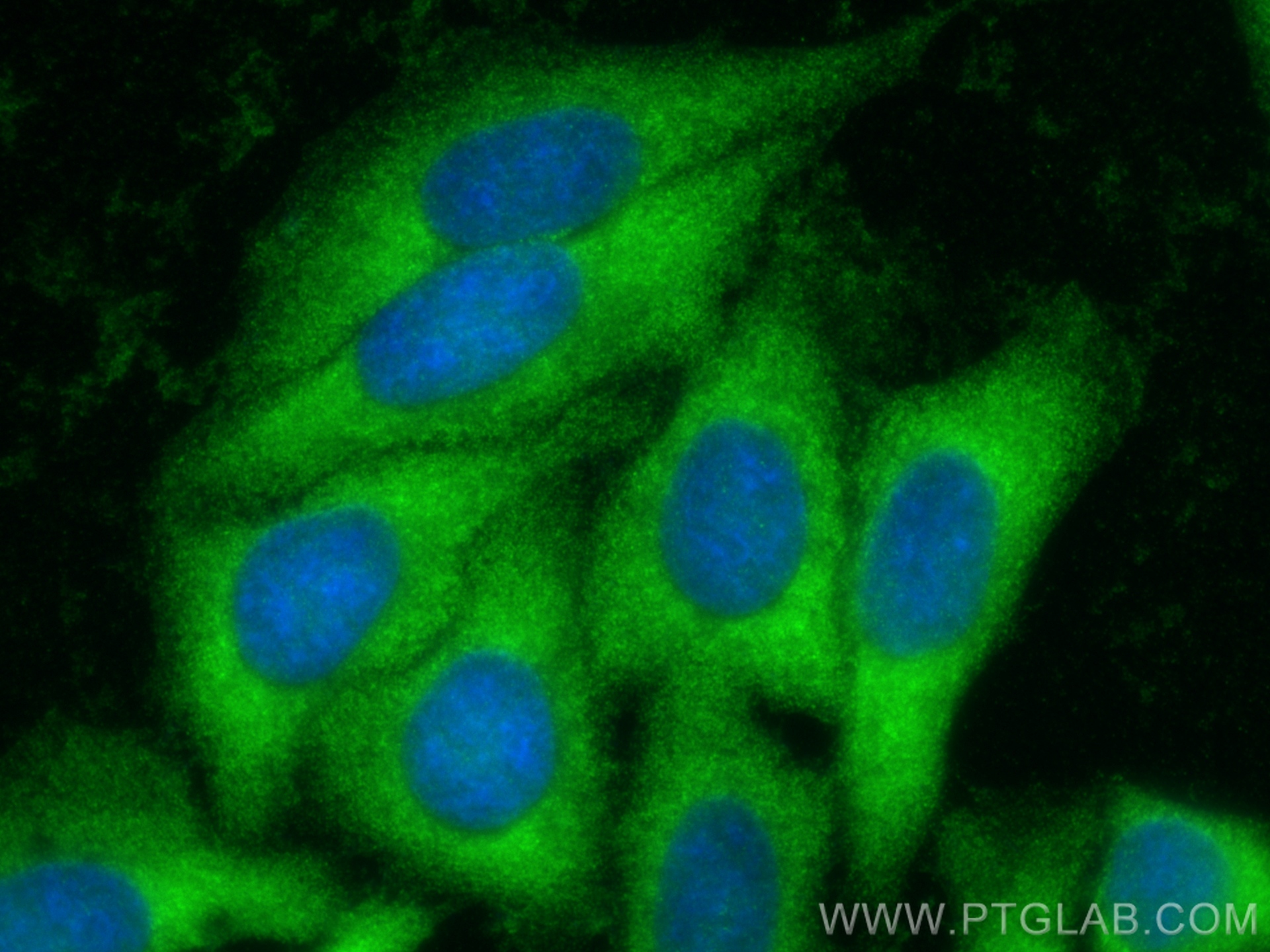 IF Staining of HepG2 using 25174-1-AP