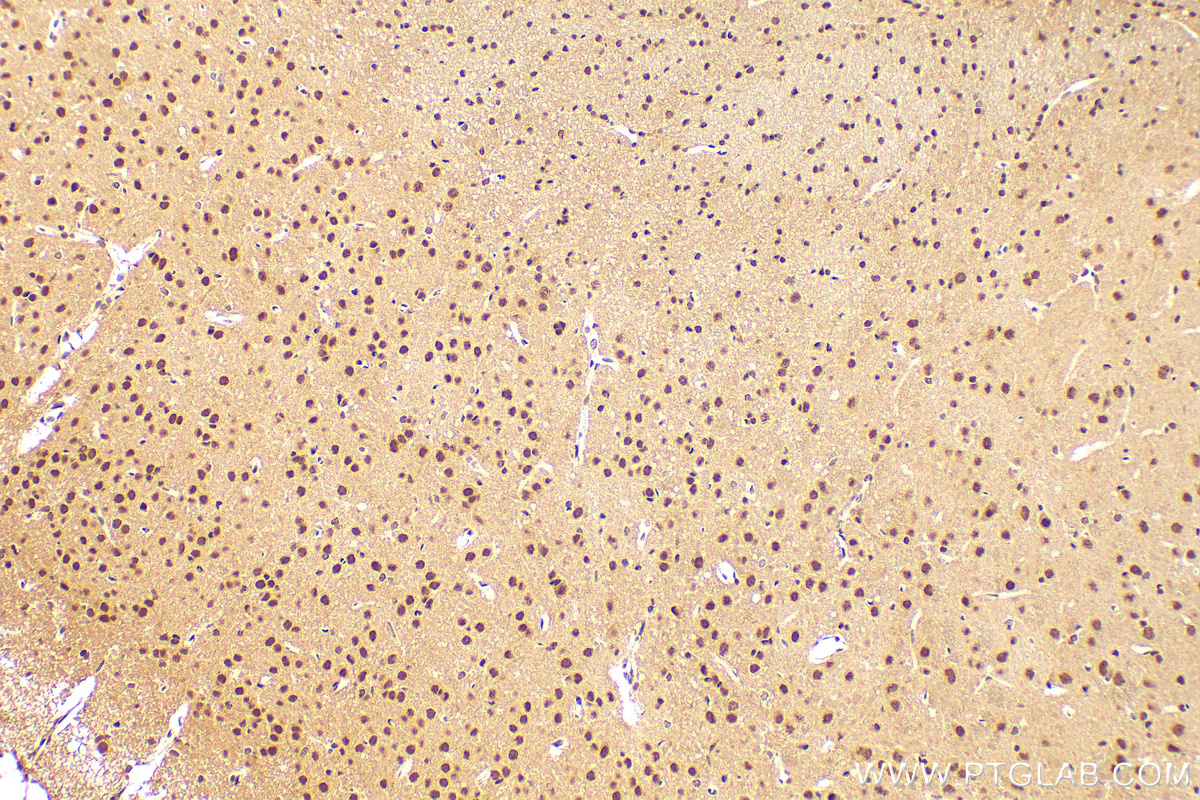 IHC staining of rat brain using 30236-1-AP