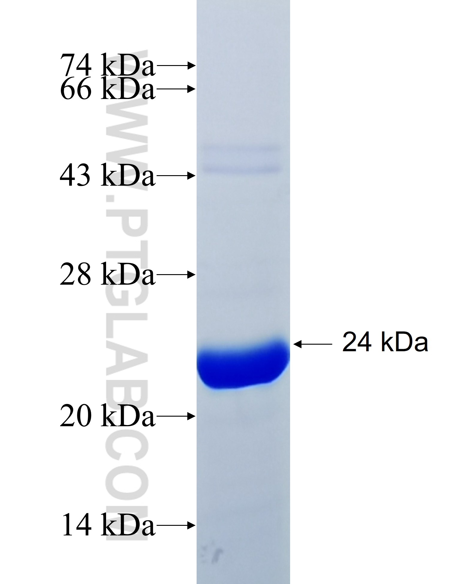 QRICH2 fusion protein Ag35048 SDS-PAGE QRICH2 fusion protein Ag35048 SDS-PAGE