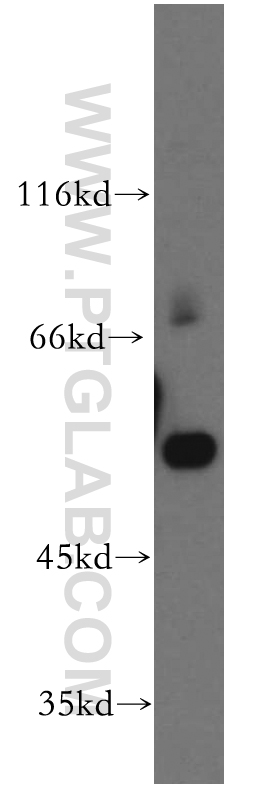 WB analysis of human placenta using 15926-1-AP (same clone as 15926-1-PBS)