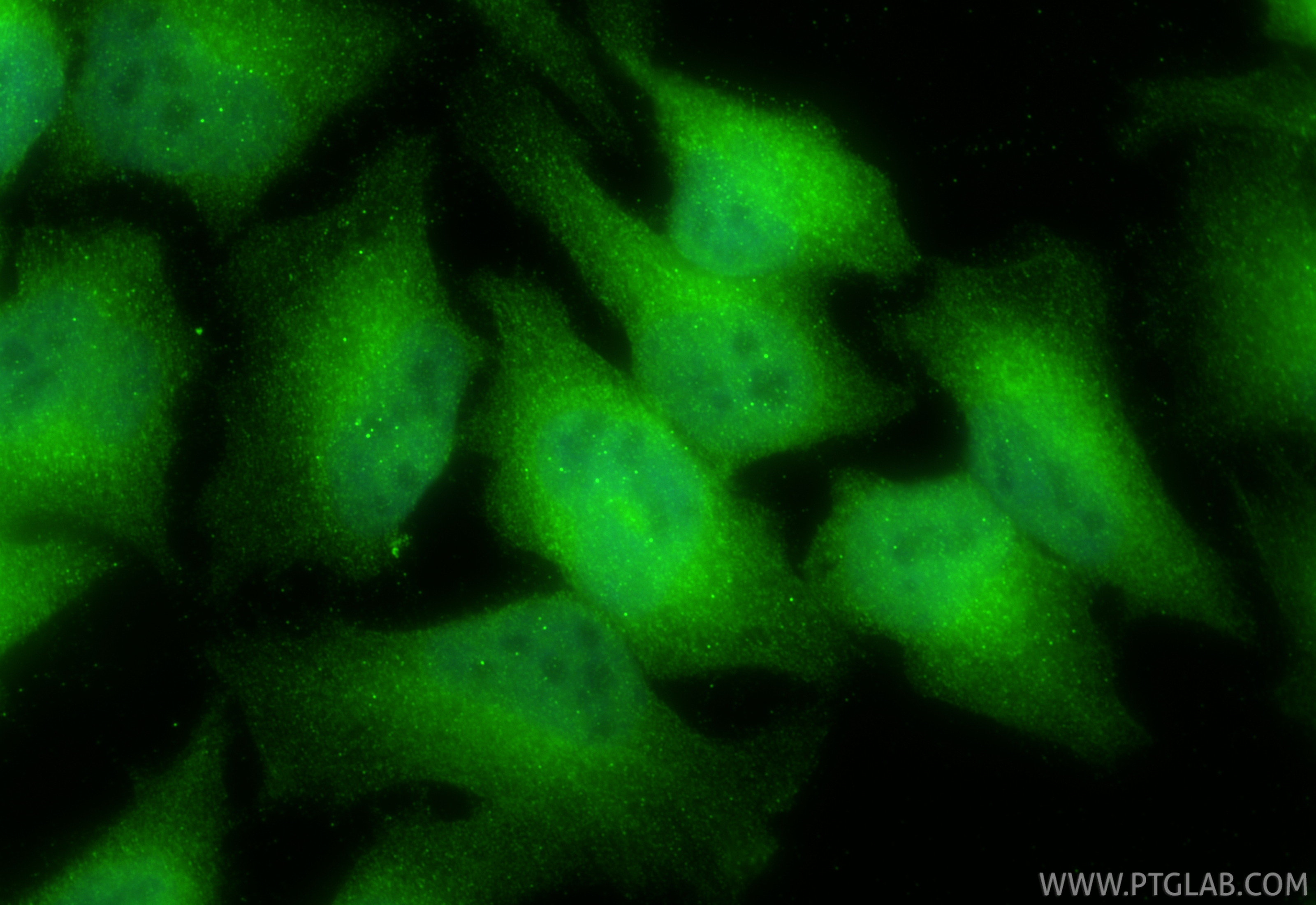 IF Staining of HeLa using 55326-1-AP (same clone as 55326-1-PBS) IF Staining of HeLa using 55326-1-AP (same clone as 55326-1-PBS)