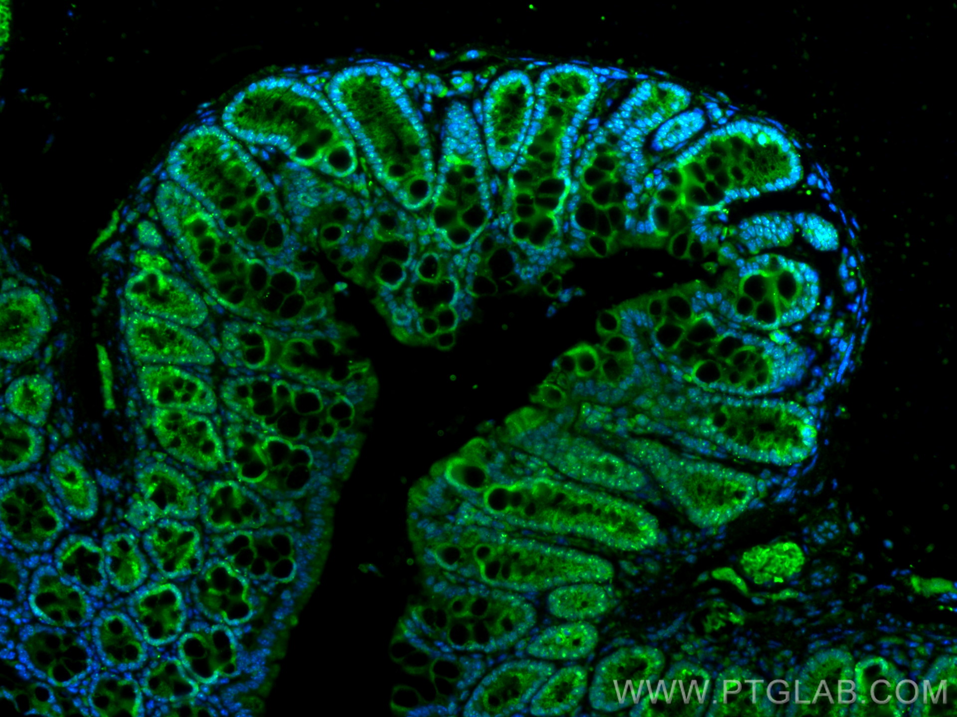IF Staining of mouse colon using 12713-1-AP