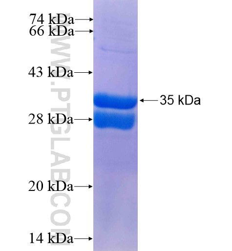 R3HDML fusion protein Ag15668 SDS-PAGE R3HDML fusion protein Ag15668 SDS-PAGE
