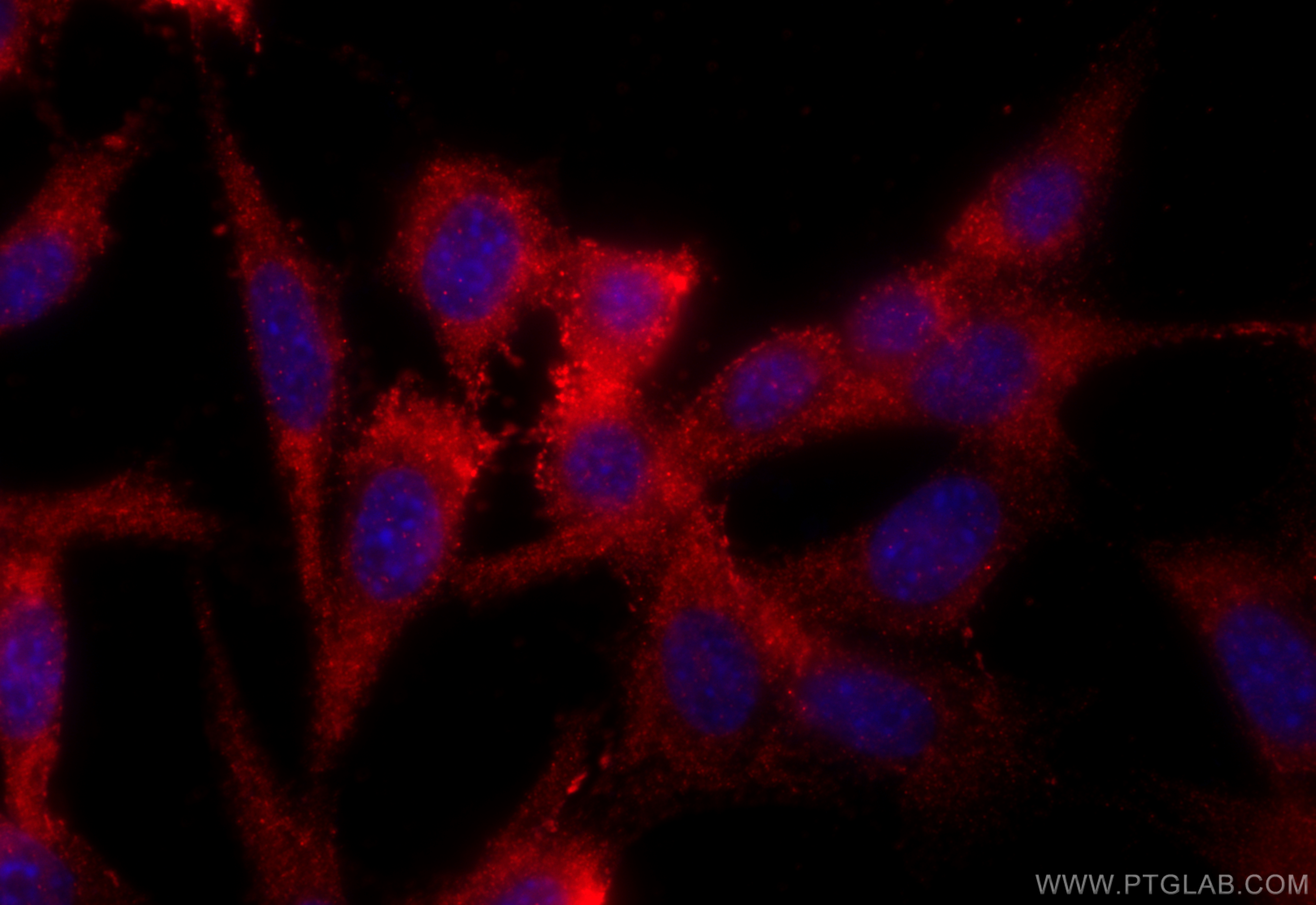 IF Staining of NIH/3T3 using 11808-1-AP
