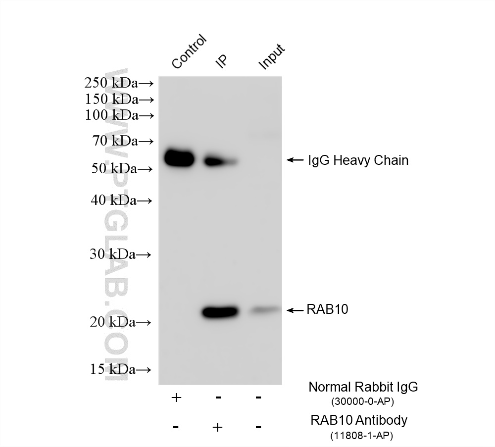 IP experiment of mouse brain using 11808-1-AP