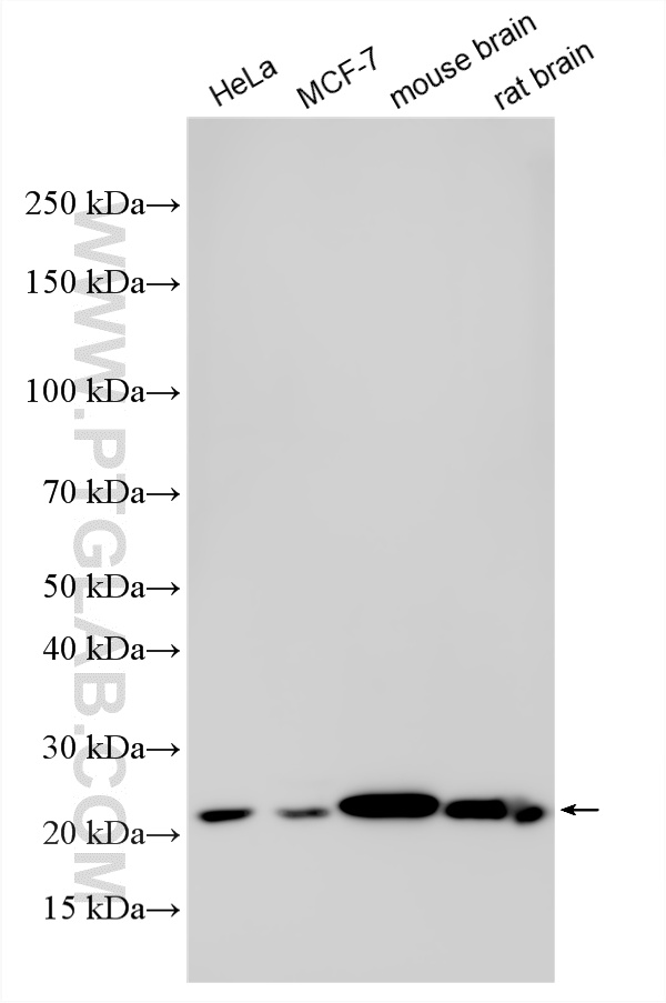 Various lysates were subjected to SDS PAGE followed by western blot with 11808-1-AP (RAB10 antibody) at dilution of 1:3000 incubated at room temperature for 1.5 hours. WB analysis using 11808-1-AP