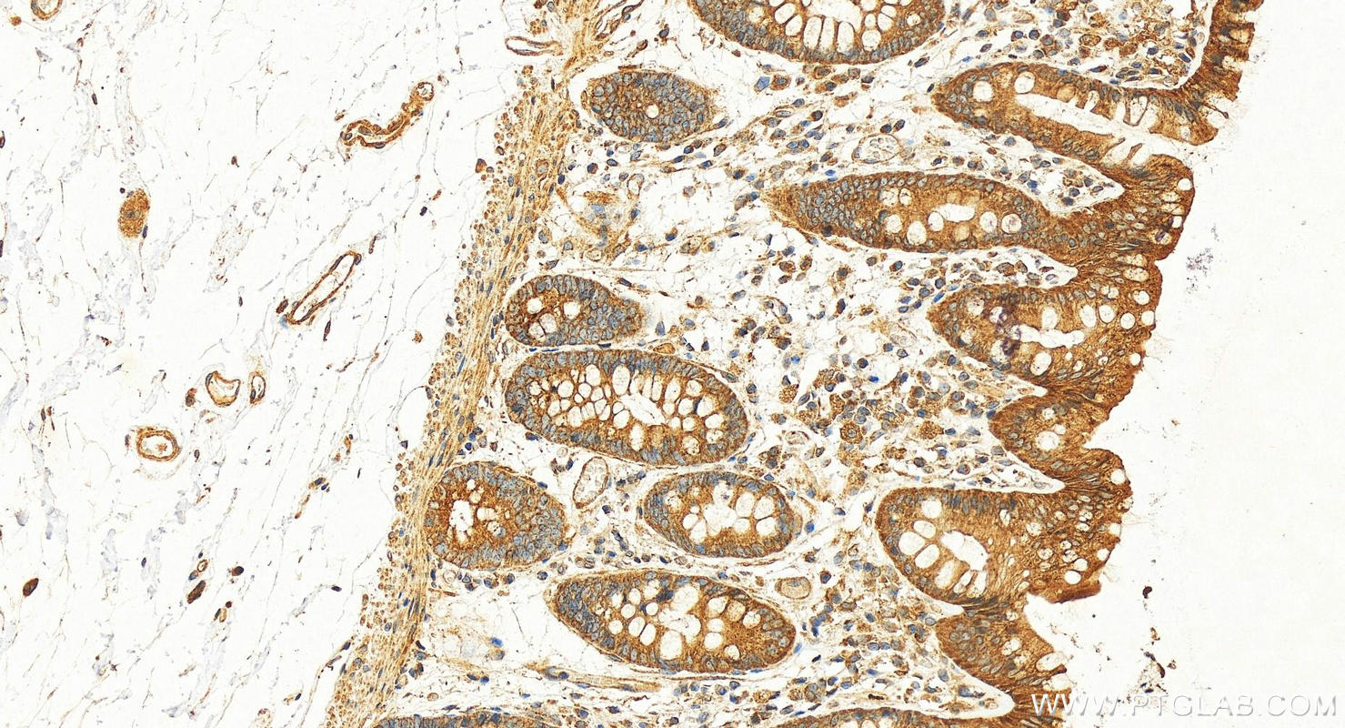 IHC staining of human colon using 27094-1-AP