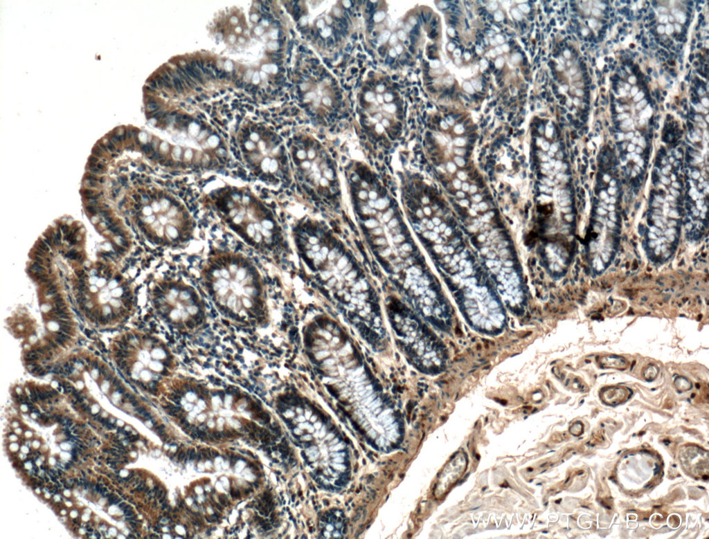 IHC staining of human colon using 27094-1-AP