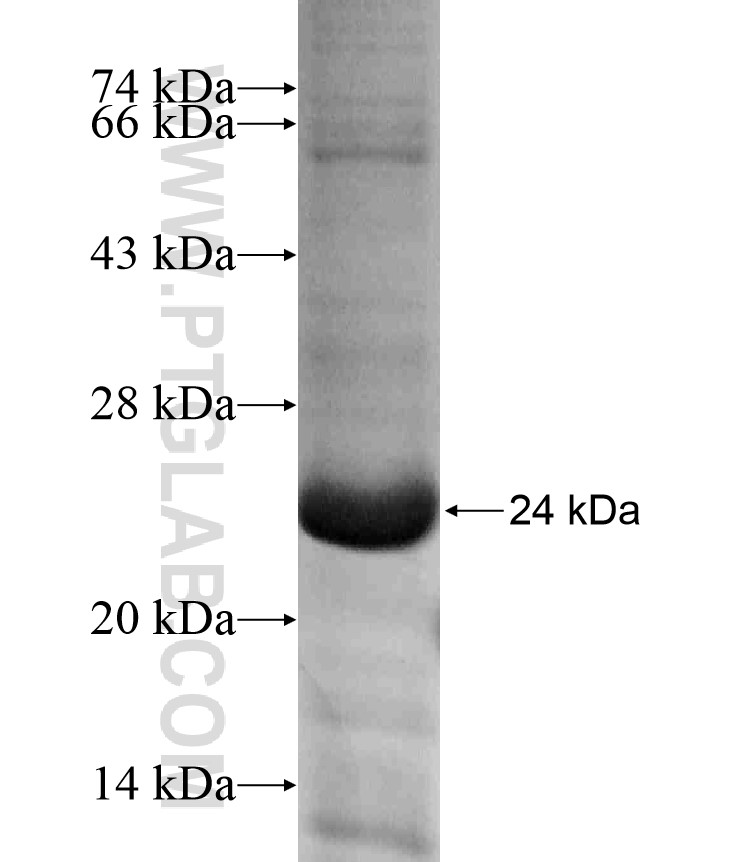 RAB10 fusion protein Ag18098 SDS-PAGE RAB10 fusion protein Ag18098 SDS-PAGE
