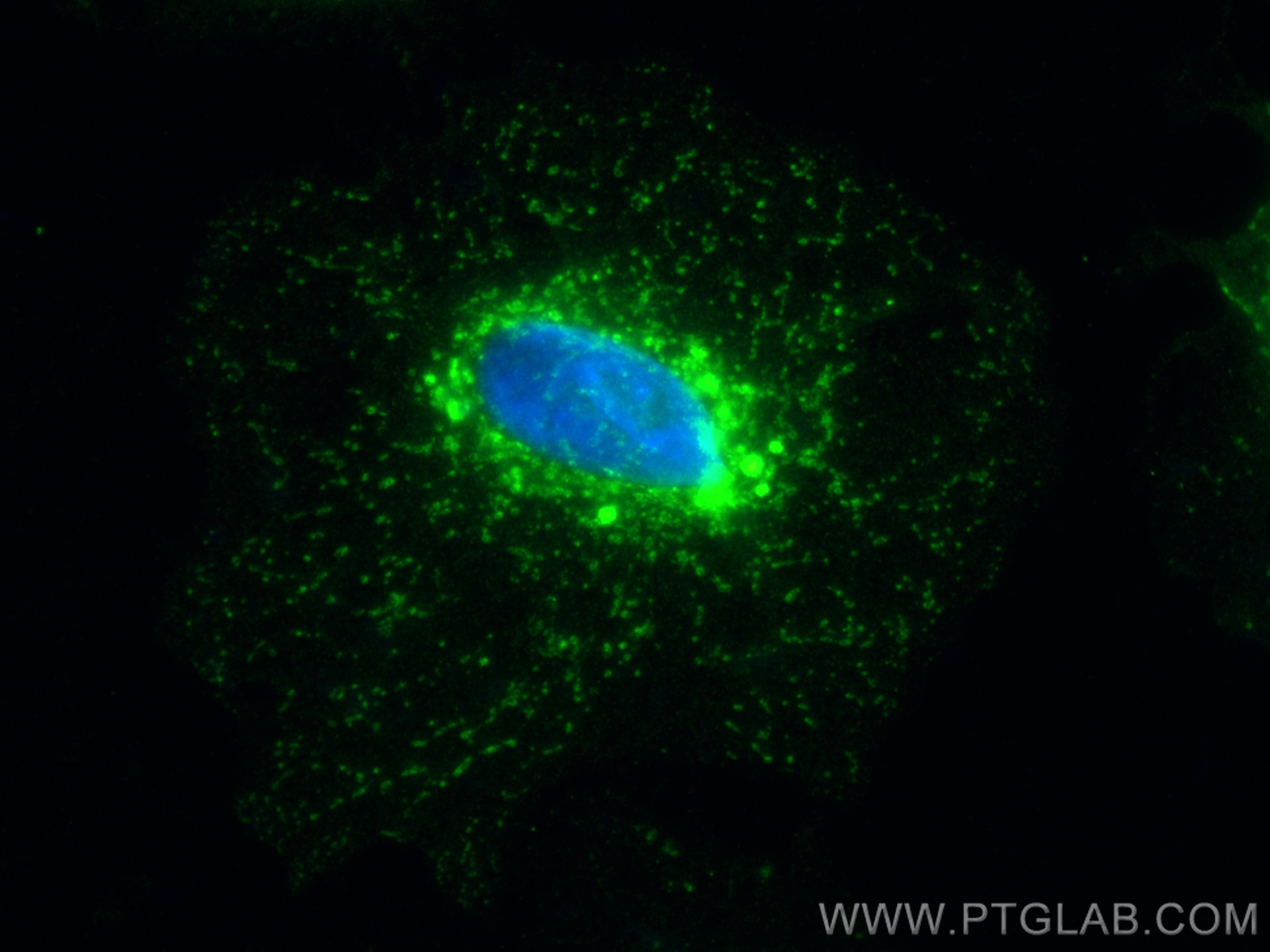 IF Staining of A549 using 15903-1-AP