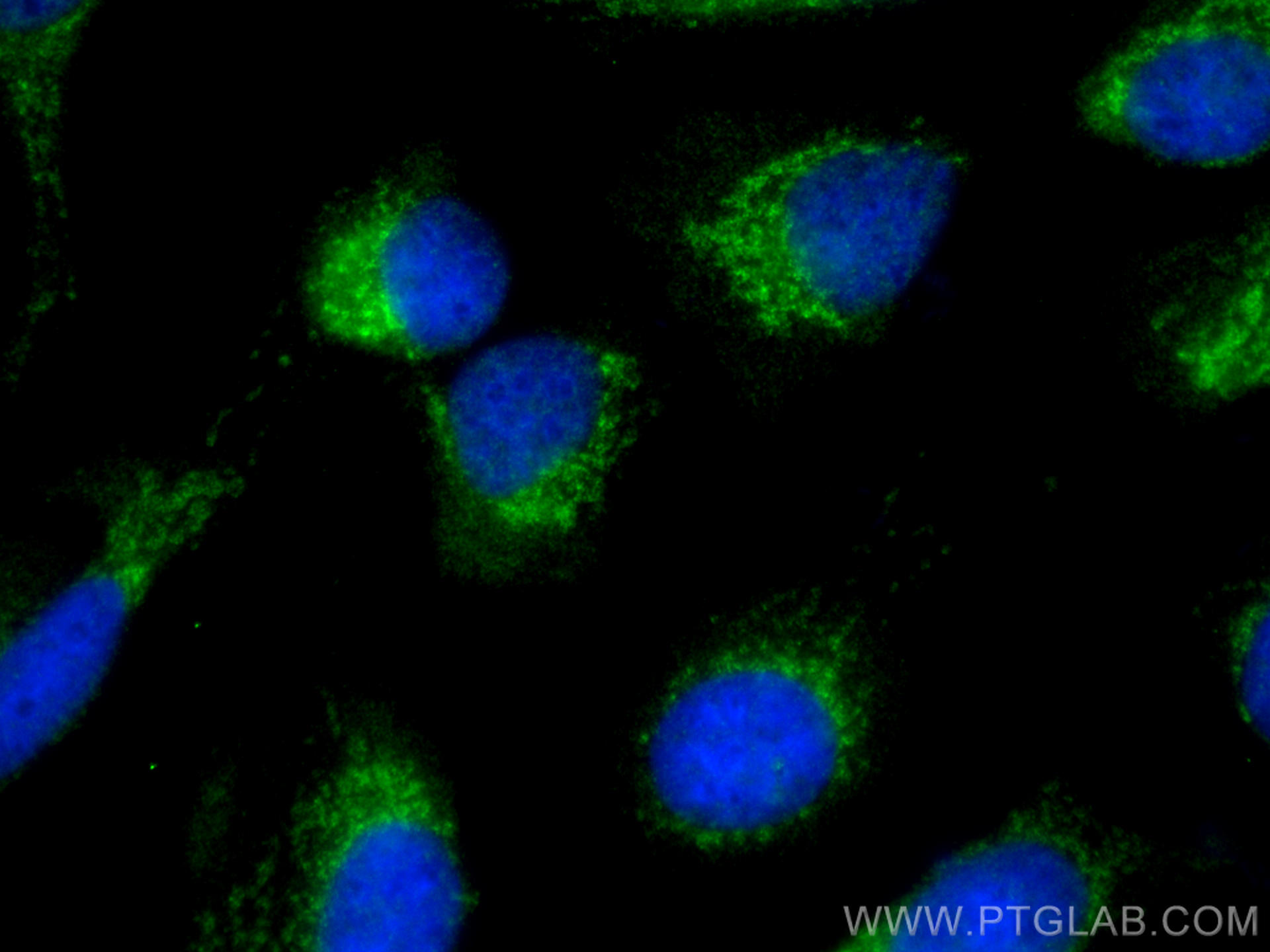 IF Staining of U2OS using 15903-1-AP