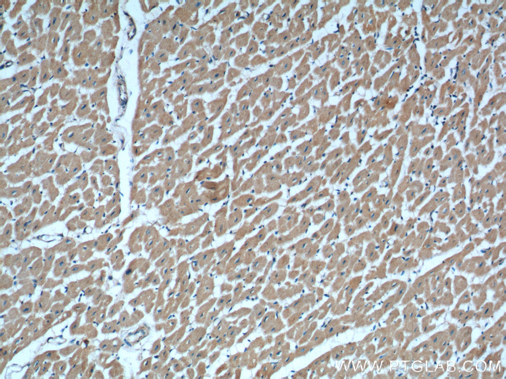 IHC staining of human heart using 15903-1-AP