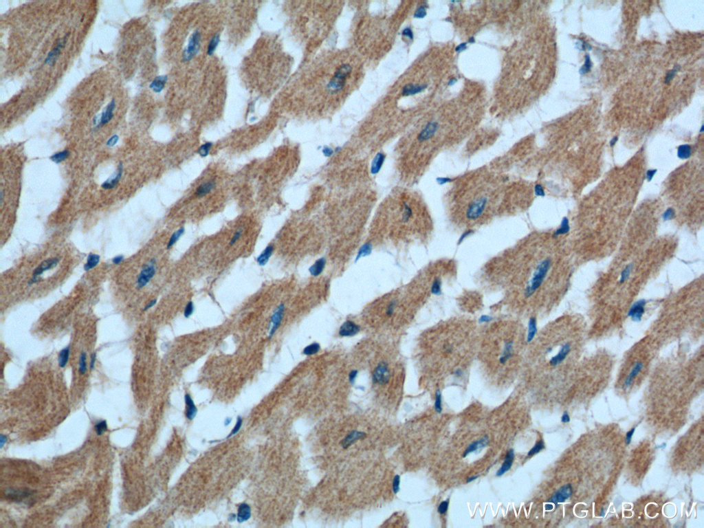 IHC staining of human heart using 15903-1-AP