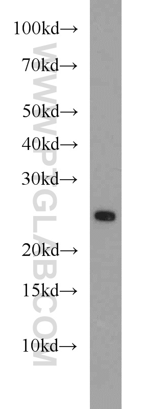 WB analysis of mouse spleen using 15903-1-AP