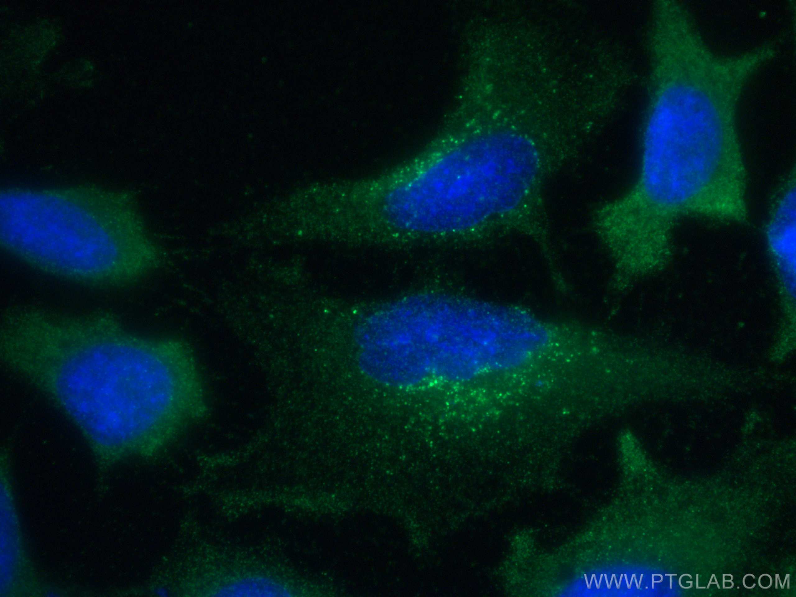 IF Staining of HeLa using 67902-1-Ig