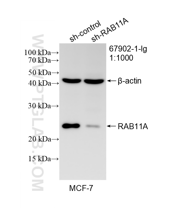 WB result of RAB11A antibody (67902-1-Ig; 1:1000; incubated at room temperature for 1.5 hours) with sh-Control and sh-RAB11A transfected MCF-7 cells. WB analysis of MCF-7 using 67902-1-Ig