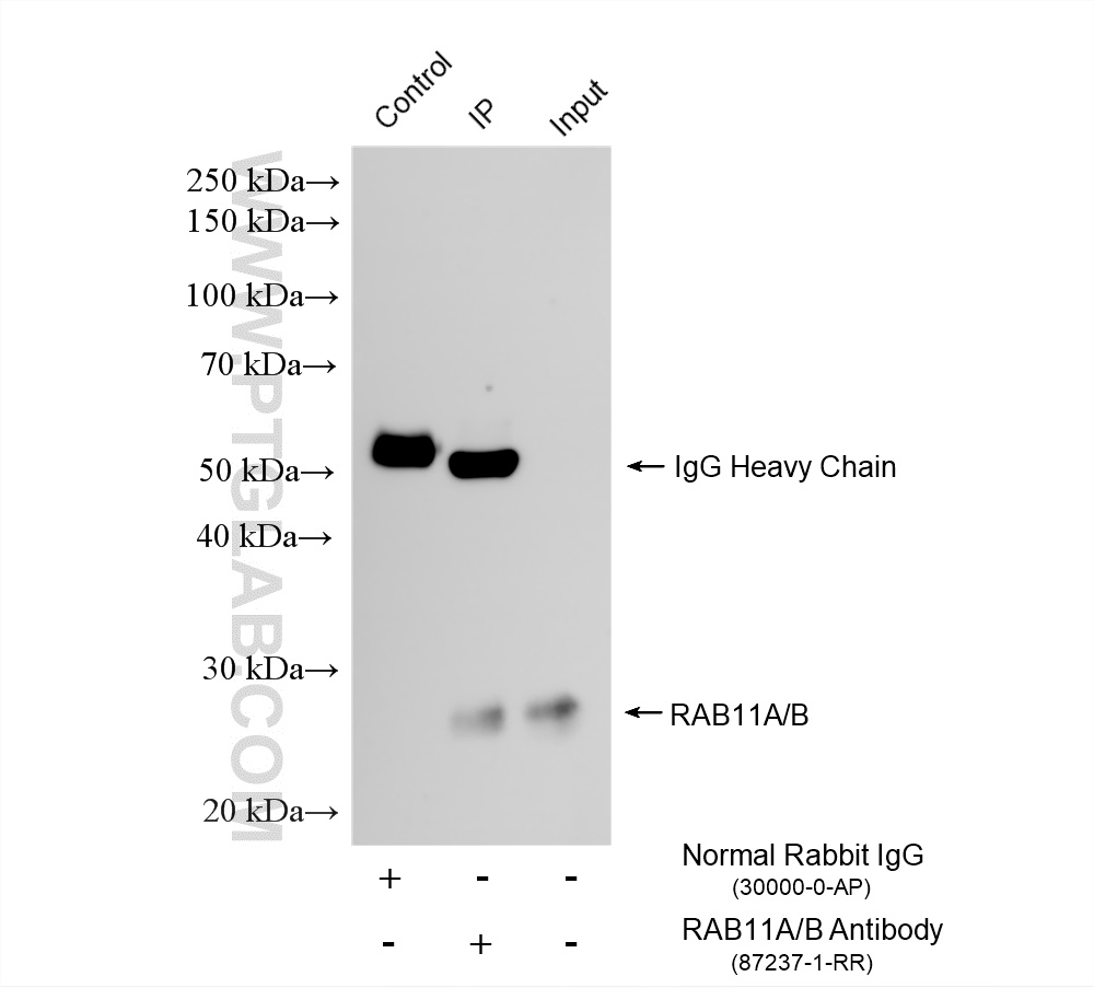 IP experiment of mouse spleen using 87237-1-RR (same clone as 87237-1-PBS) IP experiment of mouse spleen using 87237-1-RR (same clone as 87237-1-PBS)
