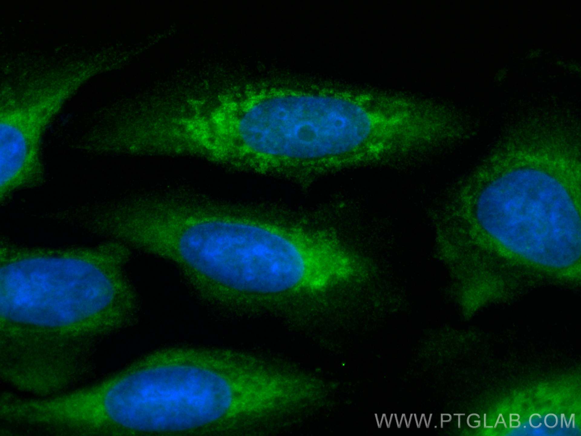 IF Staining of U2OS using CL488-15903