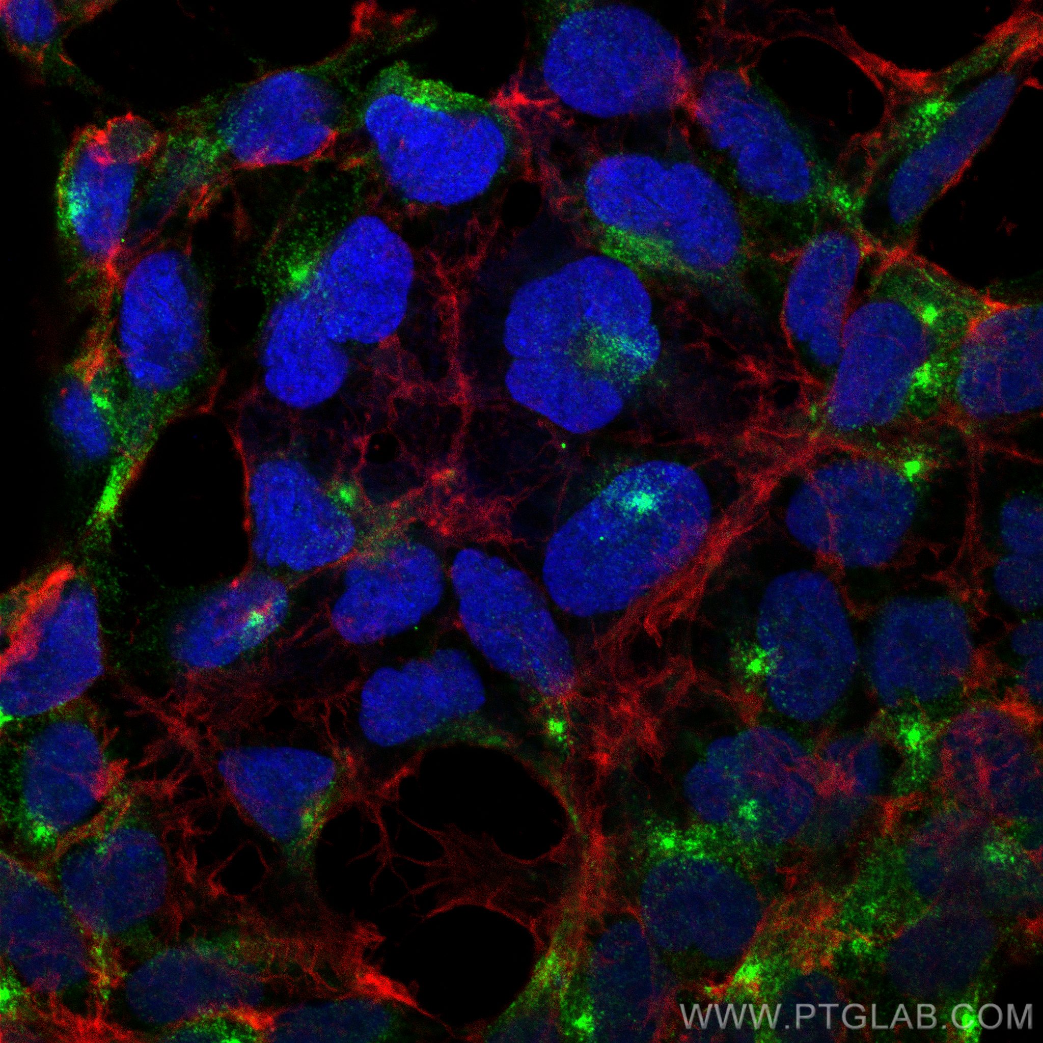 IF Staining of HEK-293 using 20229-1-AP