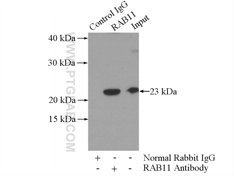 IP experiment of SH-SY5Y using 20229-1-AP