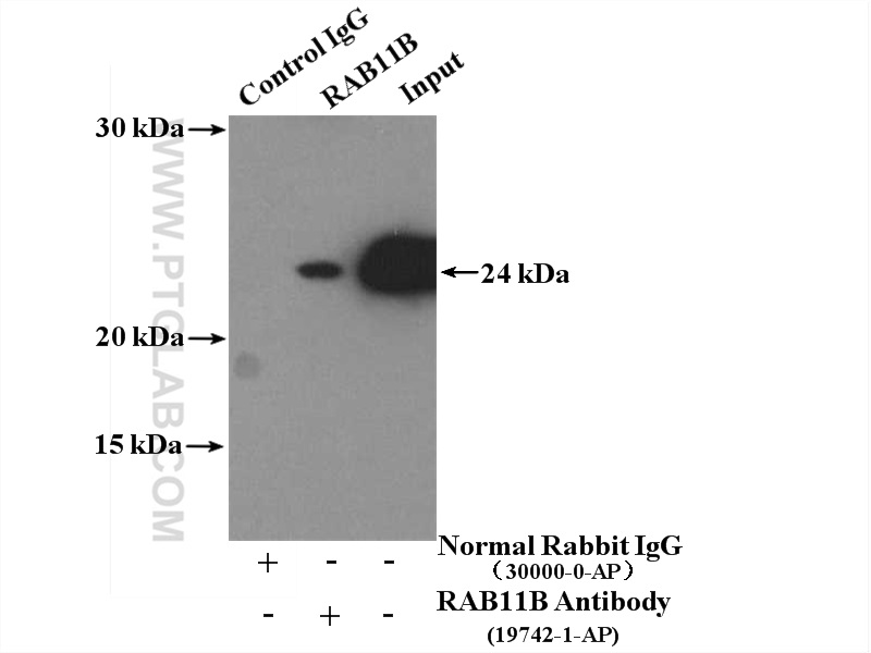 IP experiment of mouse brain using 19742-1-AP