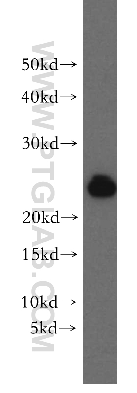 RAB11B-Specific Polyclonal antibody