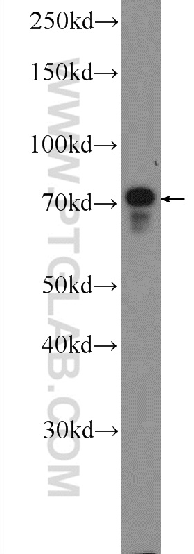 WB analysis of HepG2 using 16778-1-AP