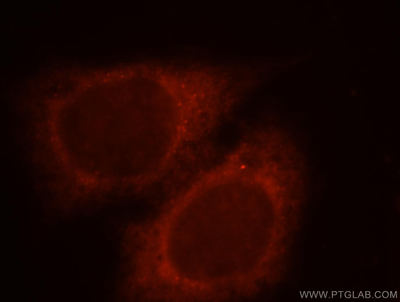IF Staining of HeLa using 18136-1-AP