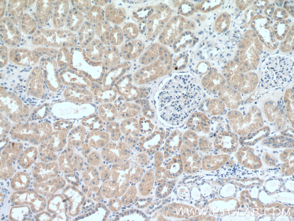 IHC staining of human kidney using 25843-1-AP