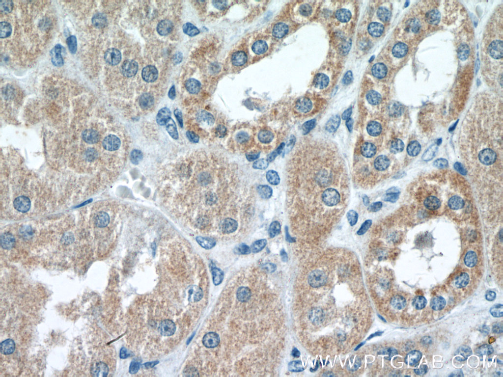 IHC staining of human kidney using 25843-1-AP