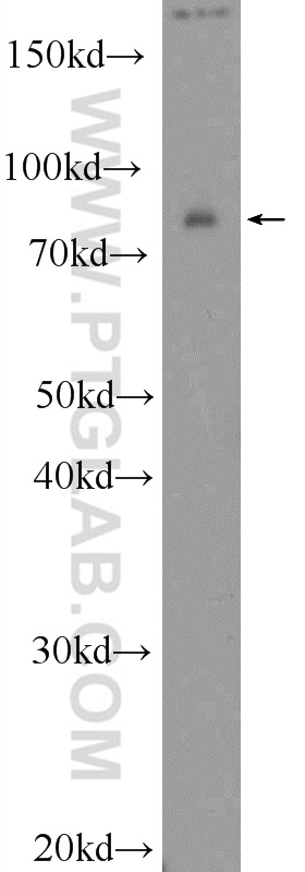 RAB11FIP3 Polyclonal antibody