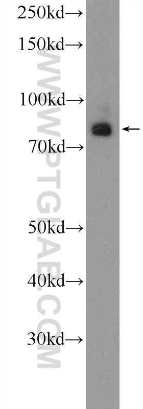 WB analysis of rat brain using 25843-1-AP