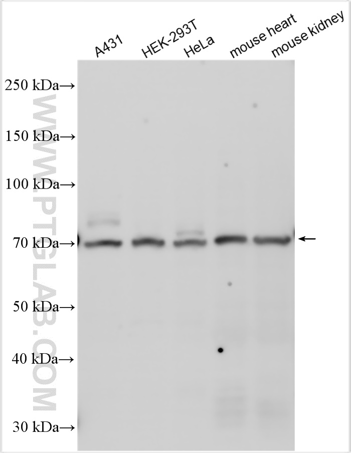 WB analysis using 14594-1-AP