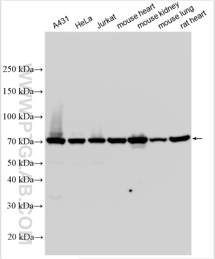 WB analysis using 14594-1-AP