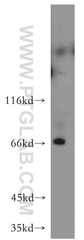 RAB11FIP5