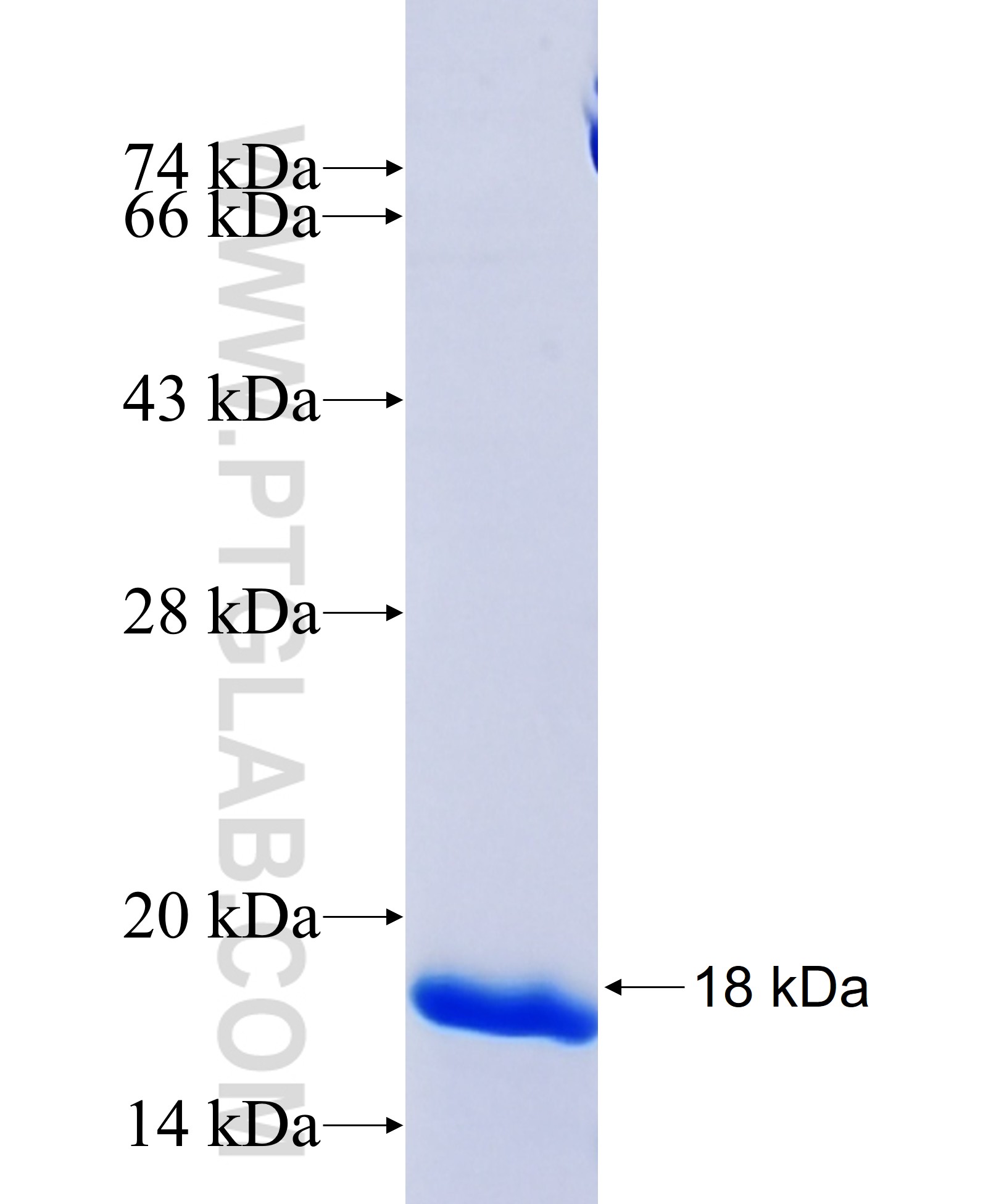 RAB11FIP5 fusion protein Ag33260 SDS-PAGE RAB11FIP5 fusion protein Ag33260 SDS-PAGE