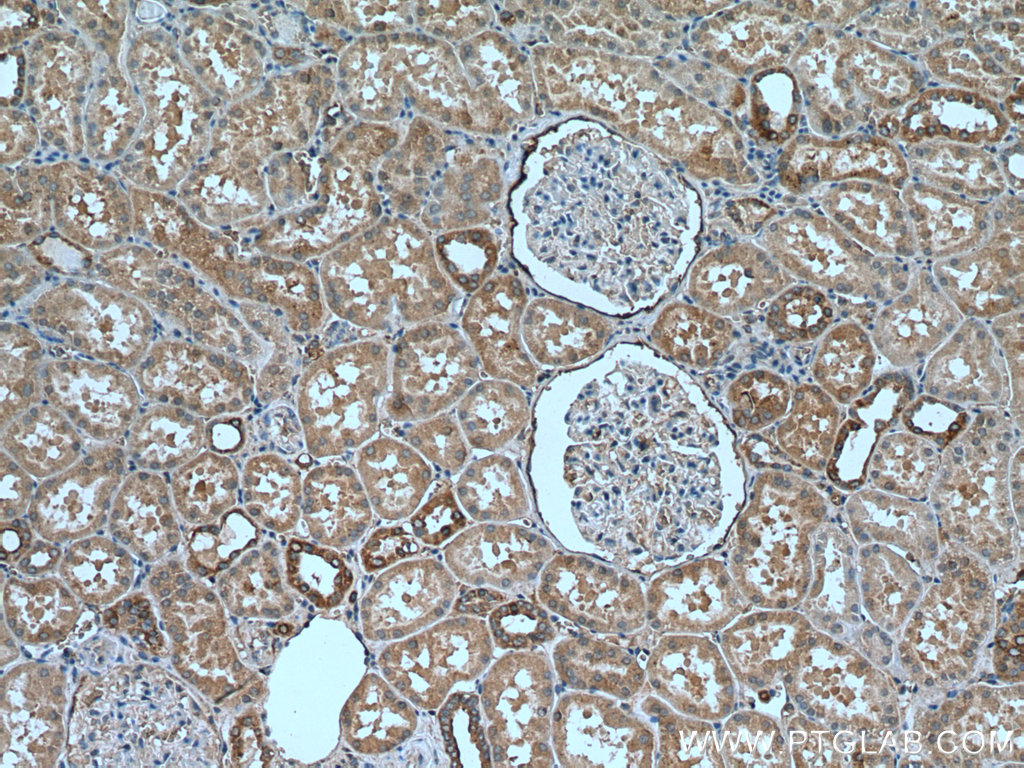 IHC staining of human kidney using 18843-1-AP