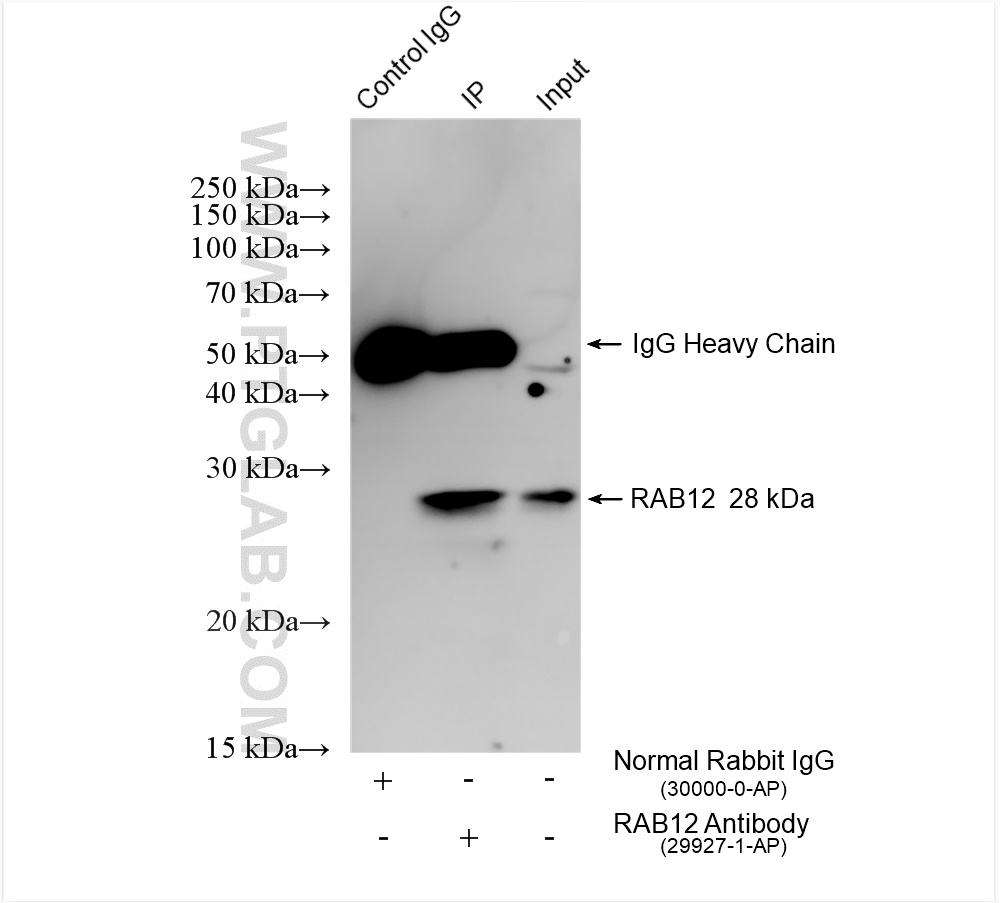 IP experiment of mouse brain using 29927-1-AP