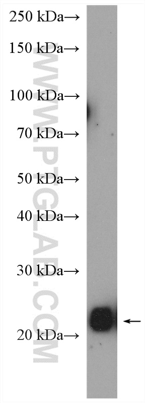 WB analysis of mouse brain using 15662-1-AP