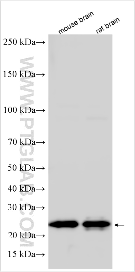 WB analysis using 15662-1-AP WB analysis using 15662-1-AP