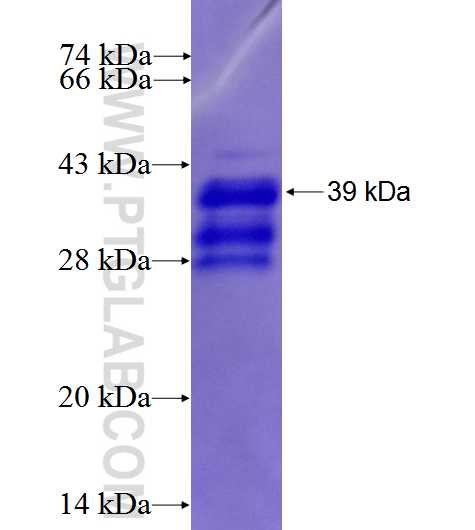 RAB17 fusion protein Ag27206 SDS-PAGE