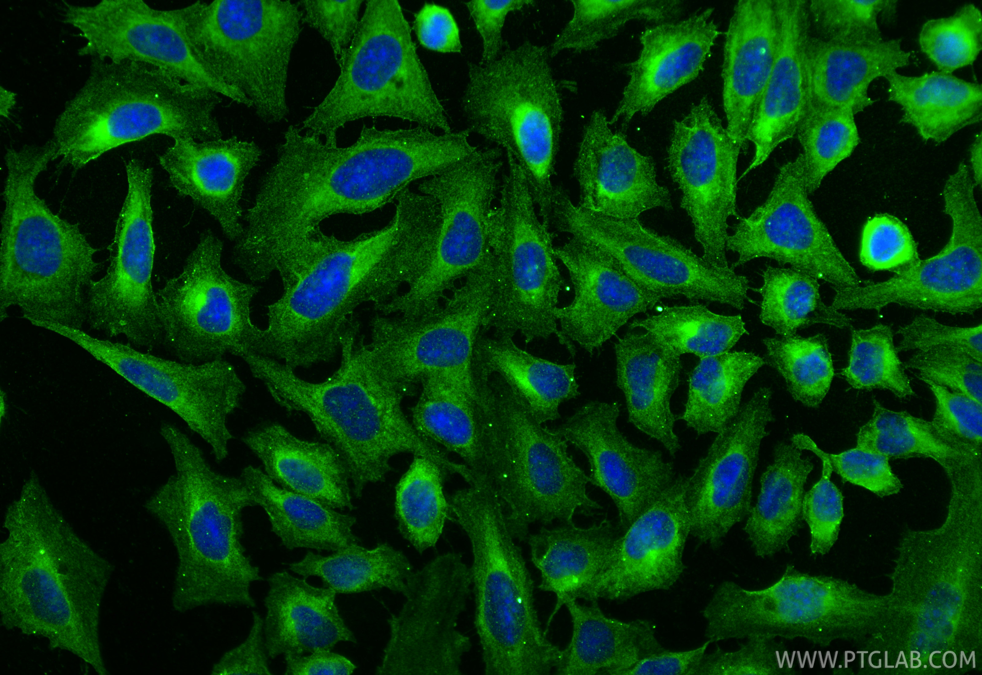 IF Staining of U2OS using 67659-1-Ig