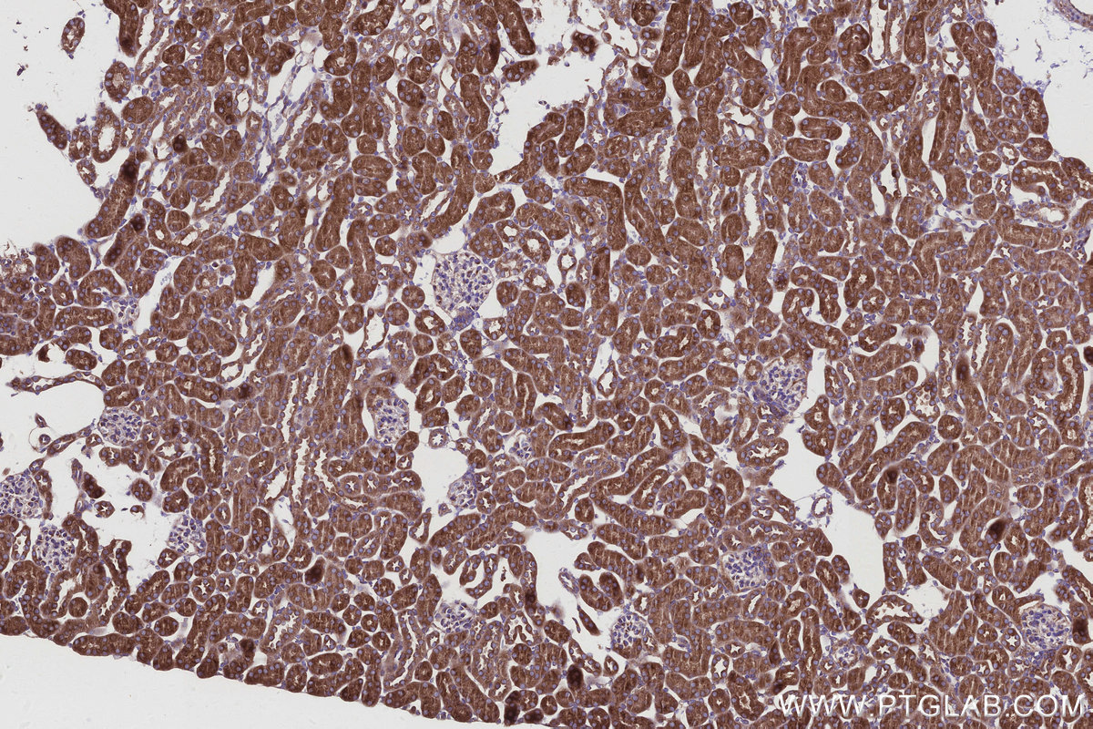 IHC staining of mouse kidney using 67659-1-Ig