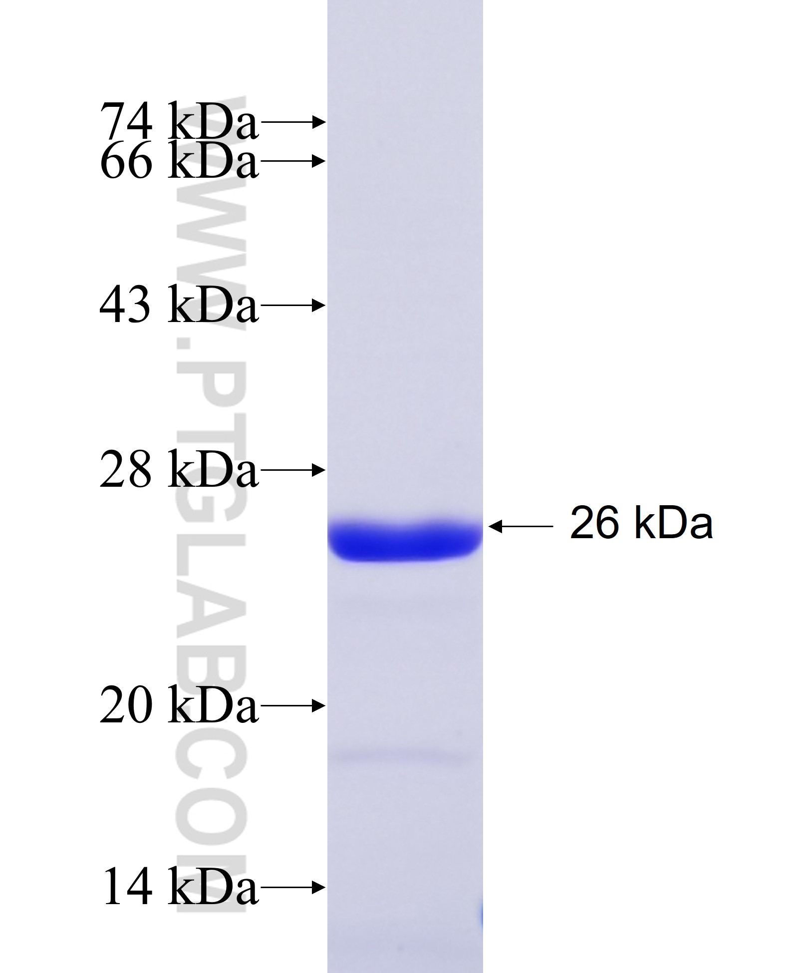 RAB18 fusion protein Ag16669 SDS-PAGE