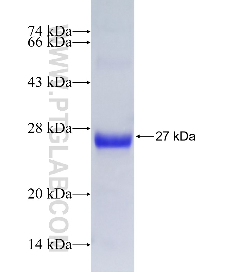 RAB1A fusion protein Ag28047 SDS-PAGE RAB1A fusion protein Ag28047 SDS-PAGE