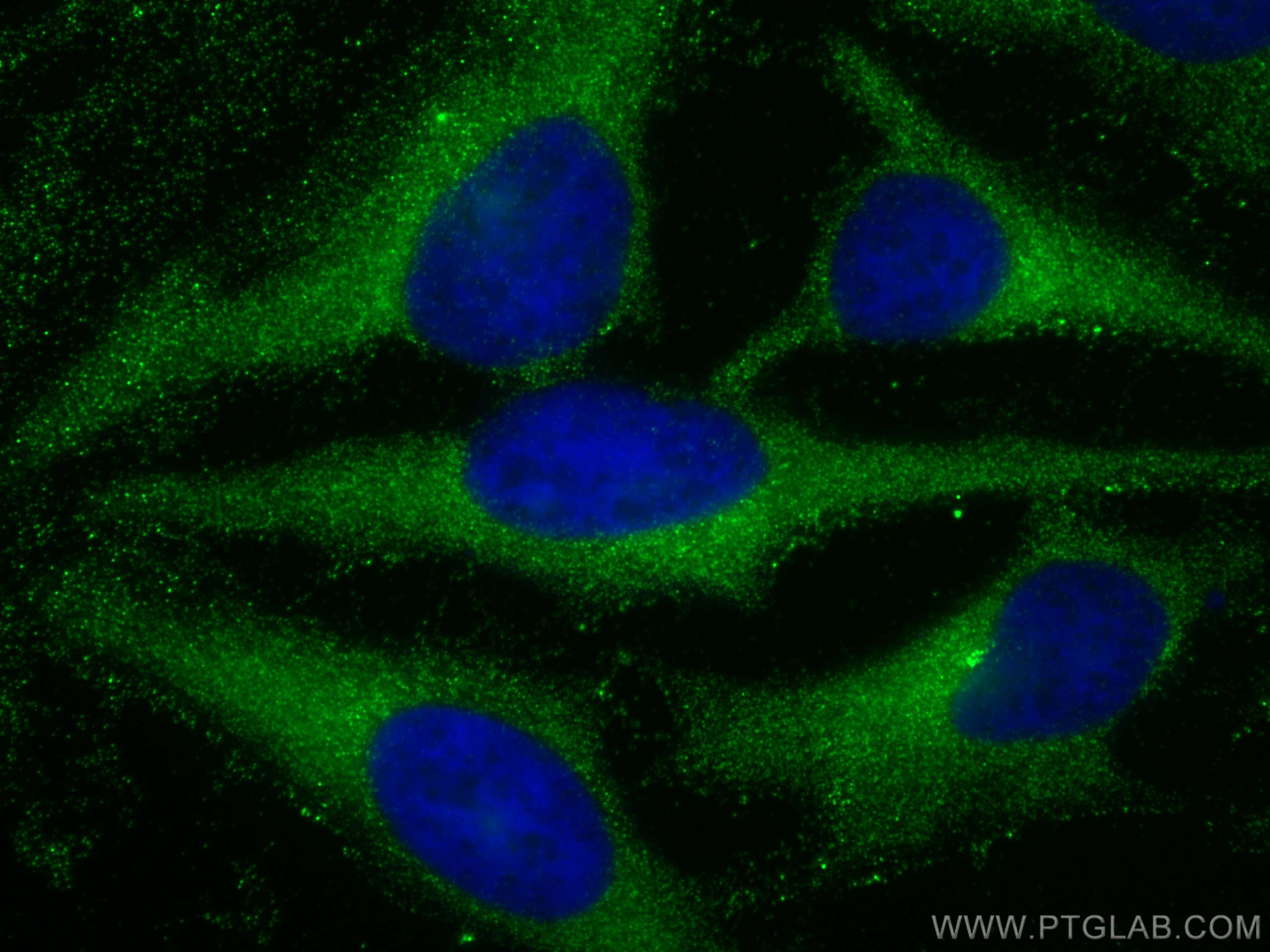 IF Staining of HeLa using 17824-1-AP